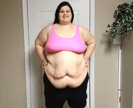 Teen Loses Over 200 Pounds Without Surgery.